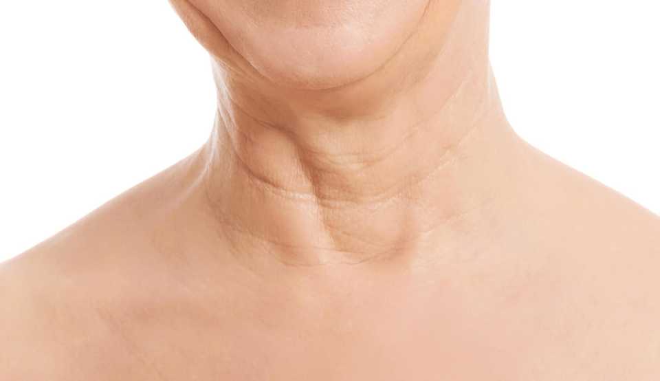 кольца венеры на шее