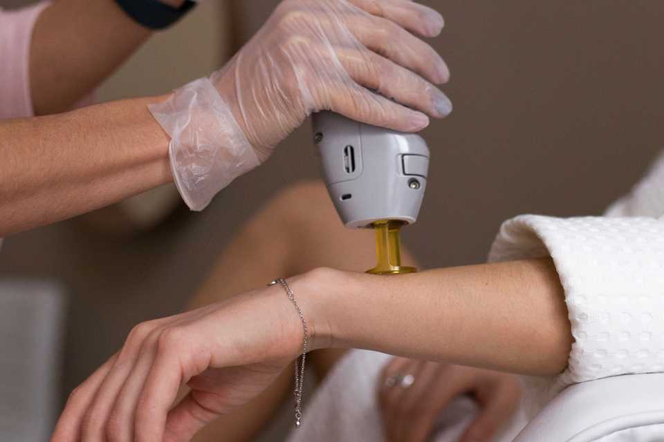 врач удаляет волосы на руке пациента Александритовым лазером