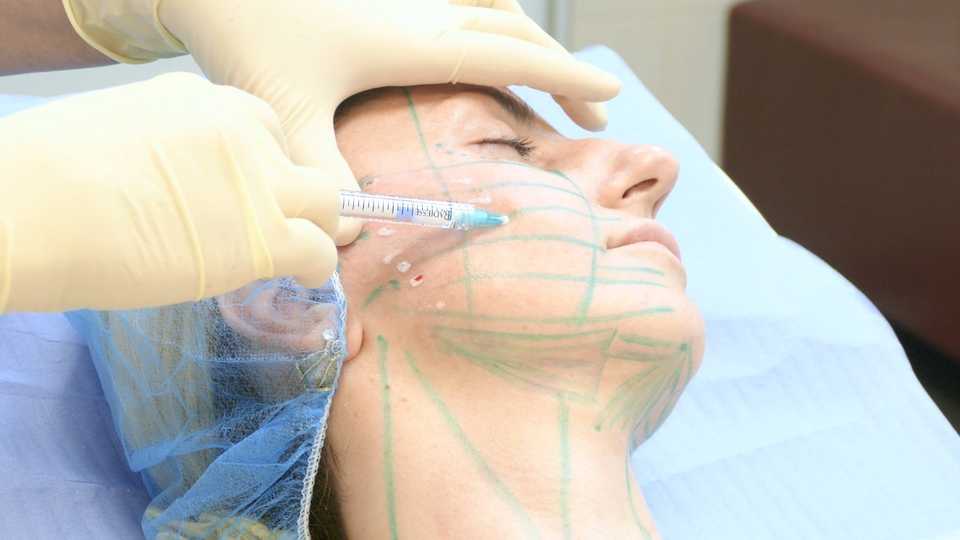 биоармирование