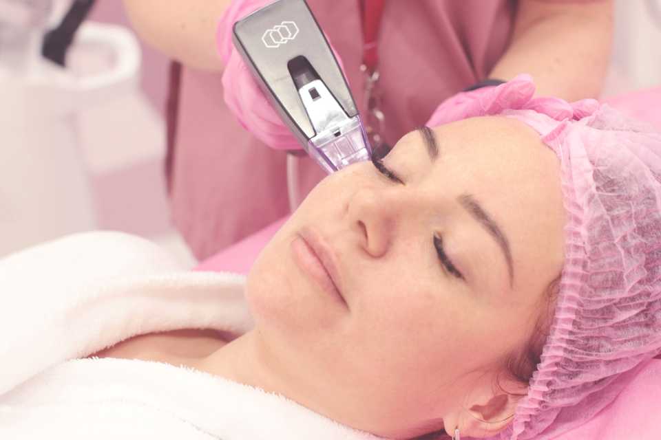 Болезненность процедуры RF лифтинга Морфеус 8